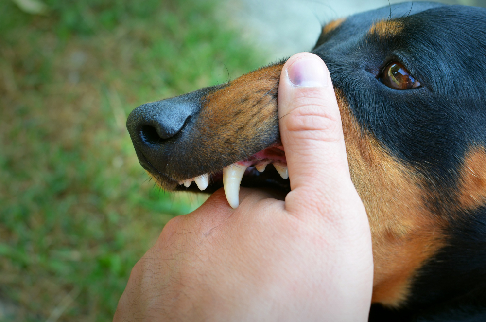 Dog bites
